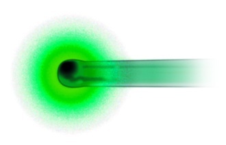 laser gengive dentista milano San Gottardo laser terapia delle gengive dentista milano San Gottardo