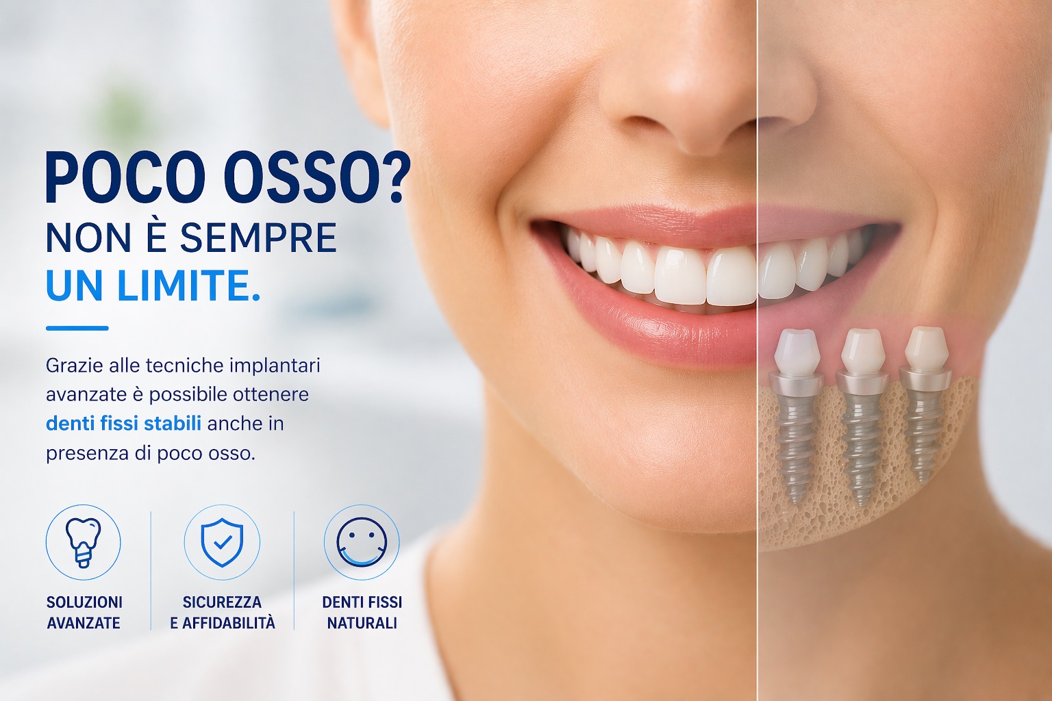 soluzione con impianti dentali e denti fissi anche in presenza di poco osso