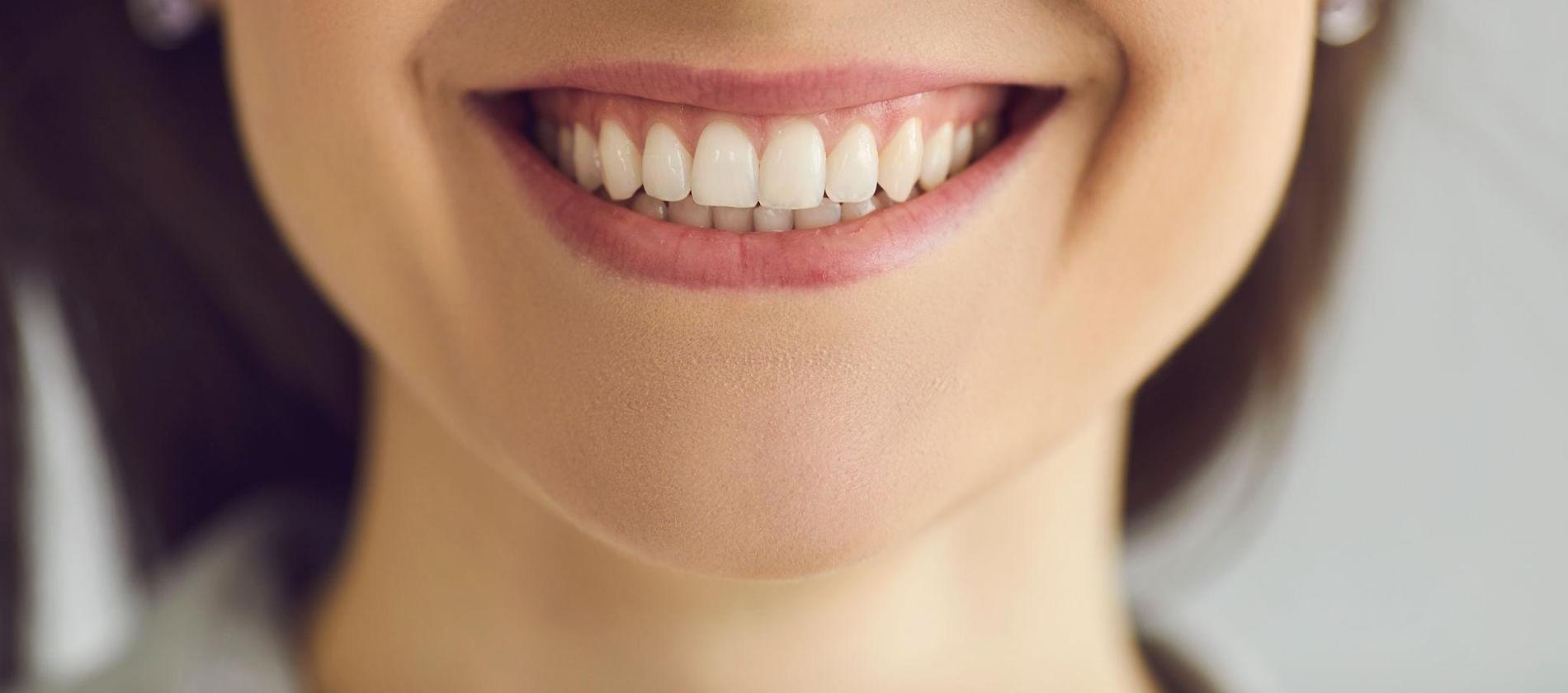 orriso naturale con denti bianchi